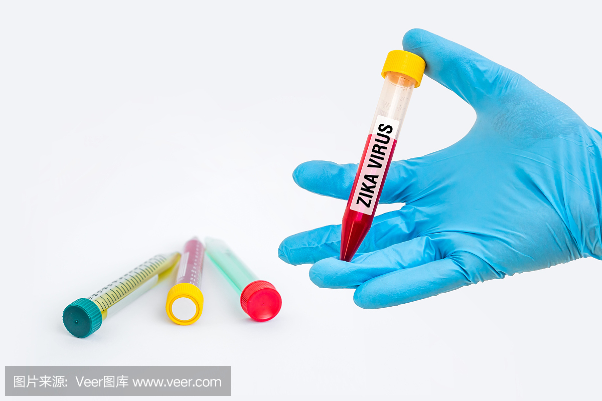 试管用于ZIKA病毒检测的血样