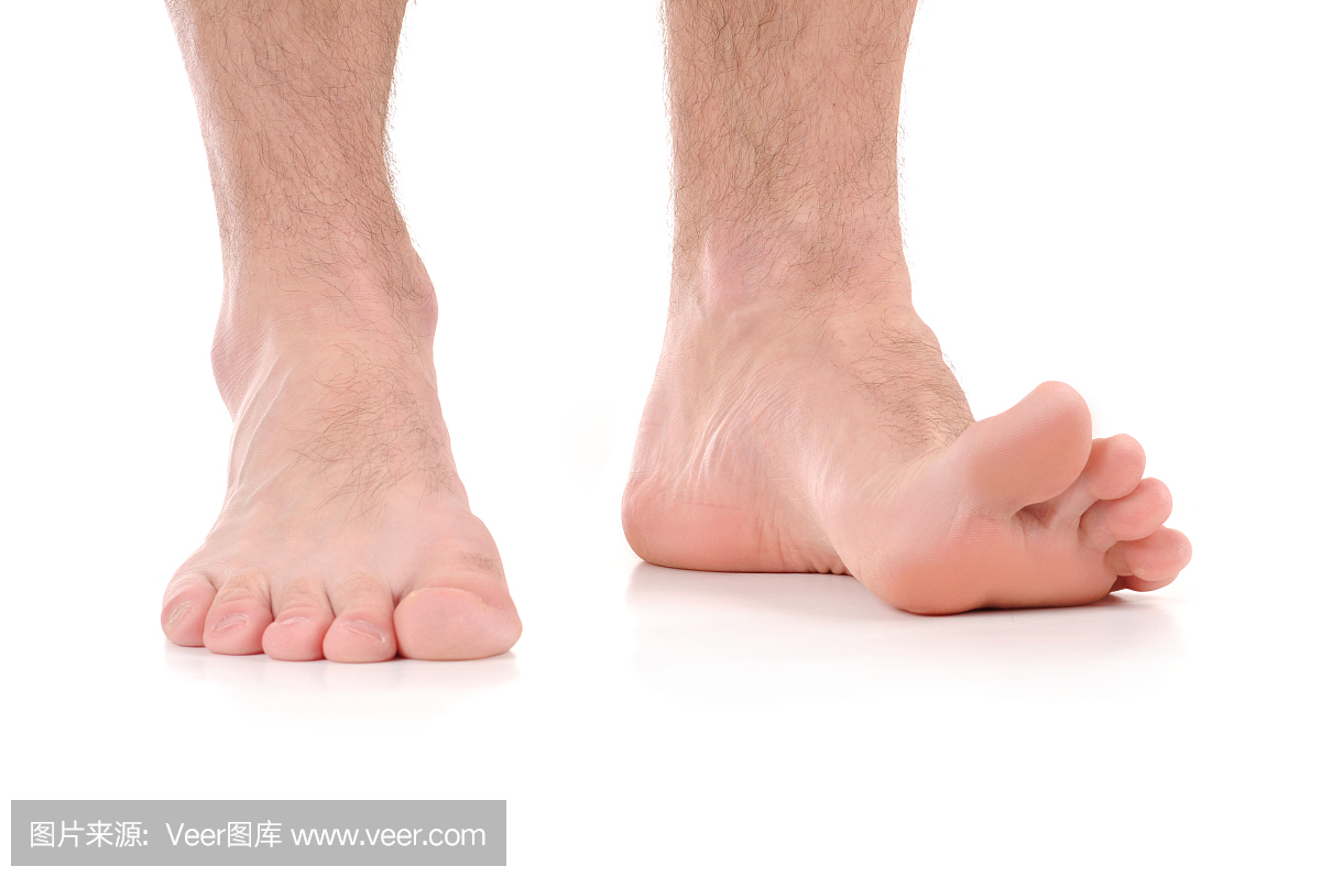 脚痒。感染由真菌引起的脚。
