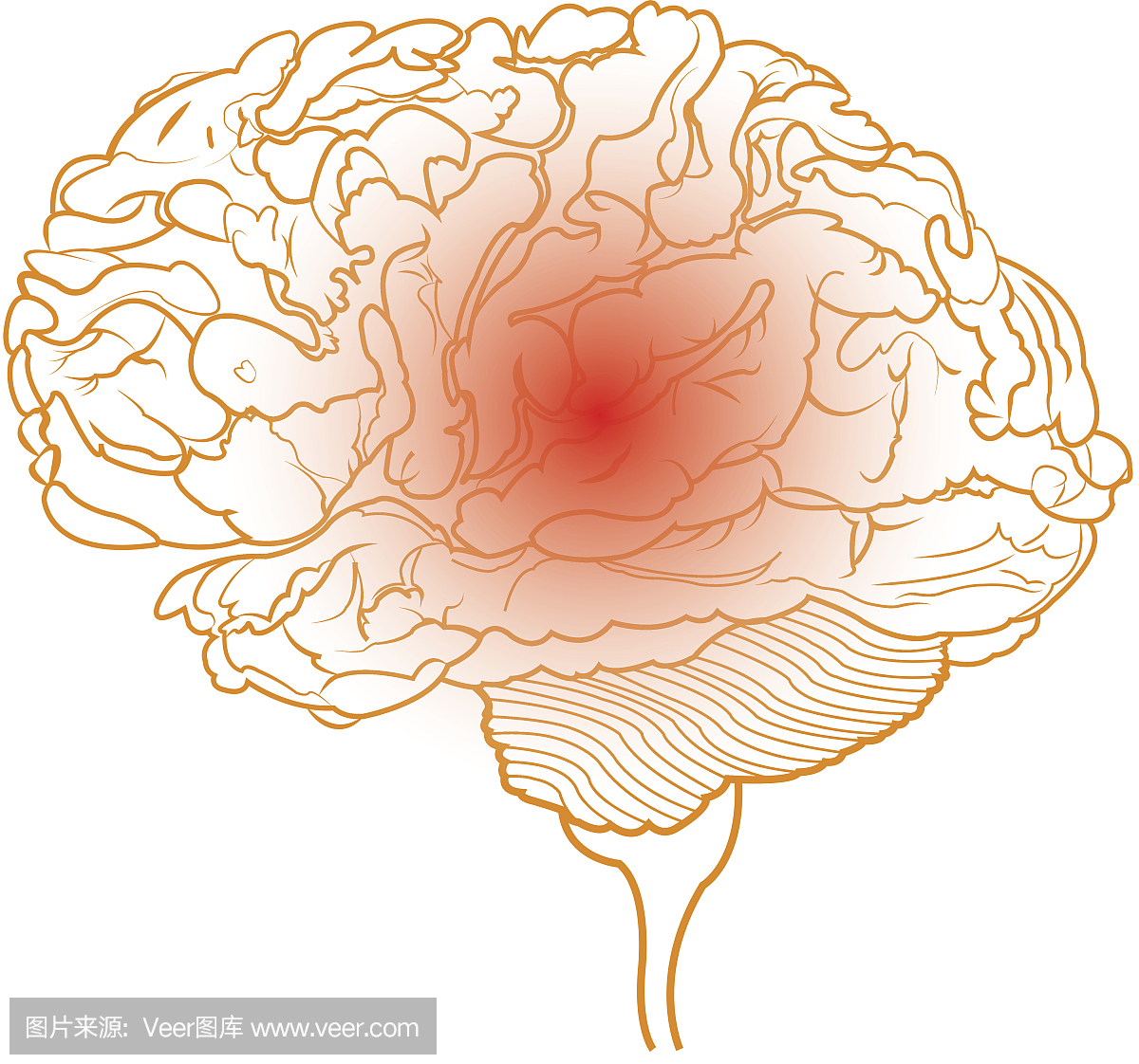 红色点和橙色线脑子背景作为病症和治疗概念,