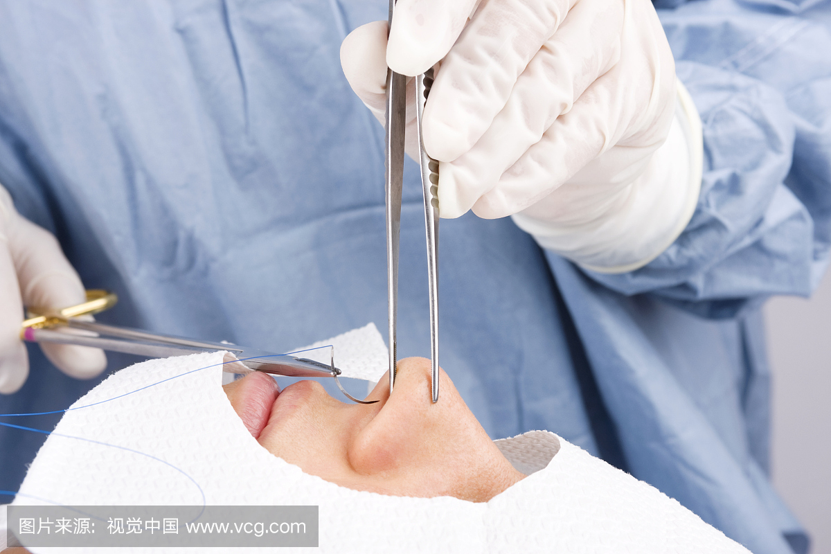 隆鼻手术,鼻子整形,鼻子整容,鼻子整形手术