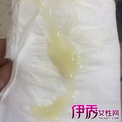 月经正常不排卵是什么原因_女明星月经正常吗_月经过后内膜厚度多少正常