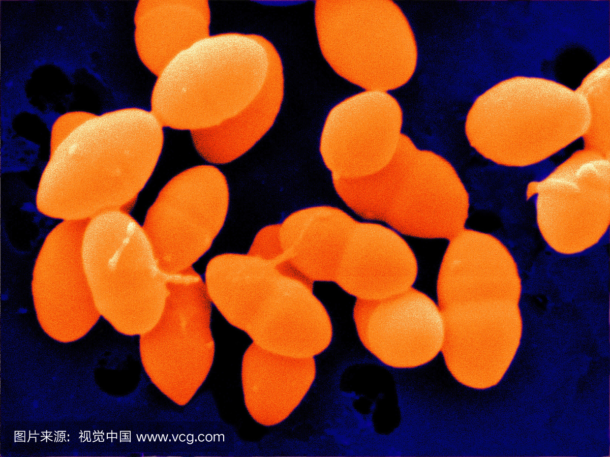 科学研究 - 东京药科大学发现具有多重耐药性的新种链球菌，命名为Streptococcus toyakuensis - 客观日本