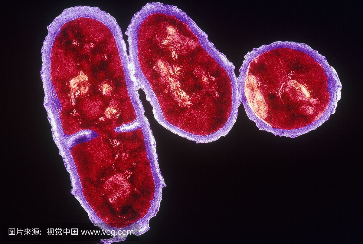 痤疮丙酸杆菌的颜色增强型TEM(透射电子显微