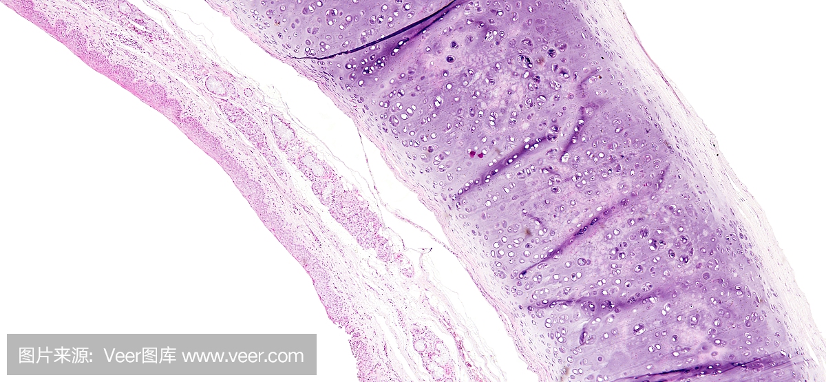 肥大,过度增大,增生,过度生长
