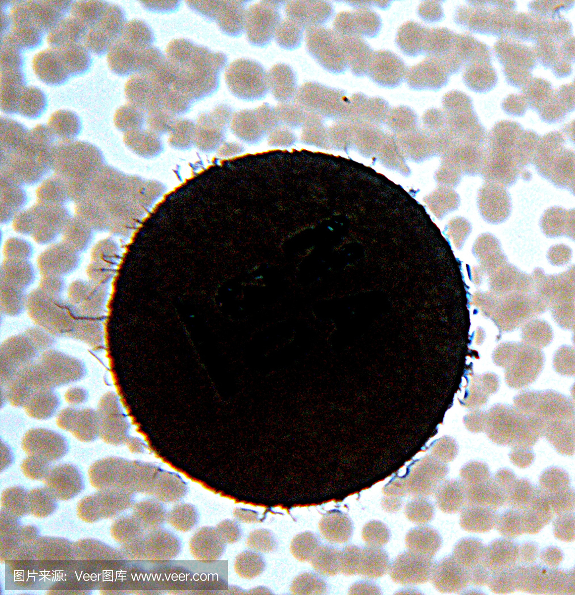 抗生素敏感性试验