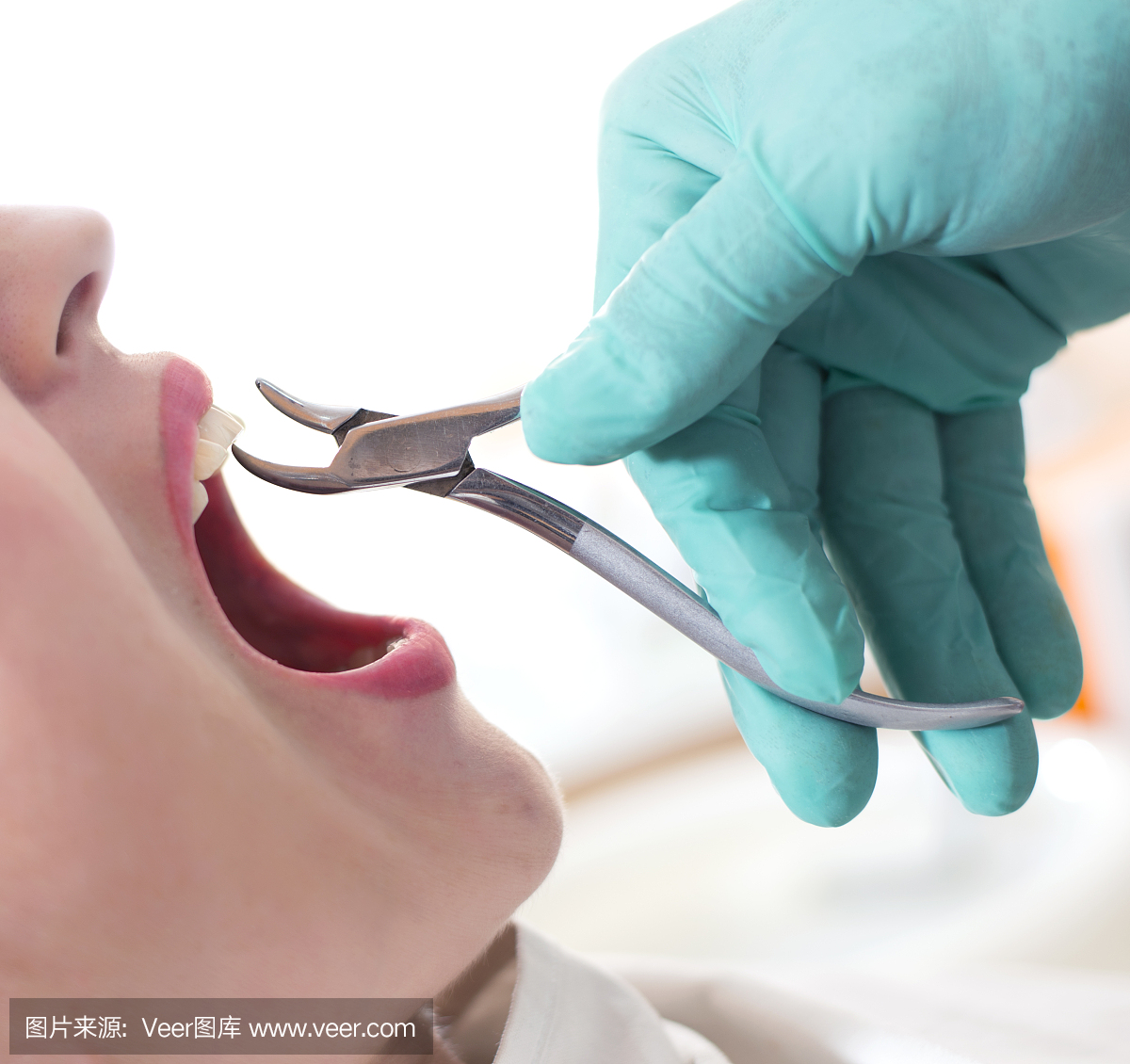 女人正在拔牙。