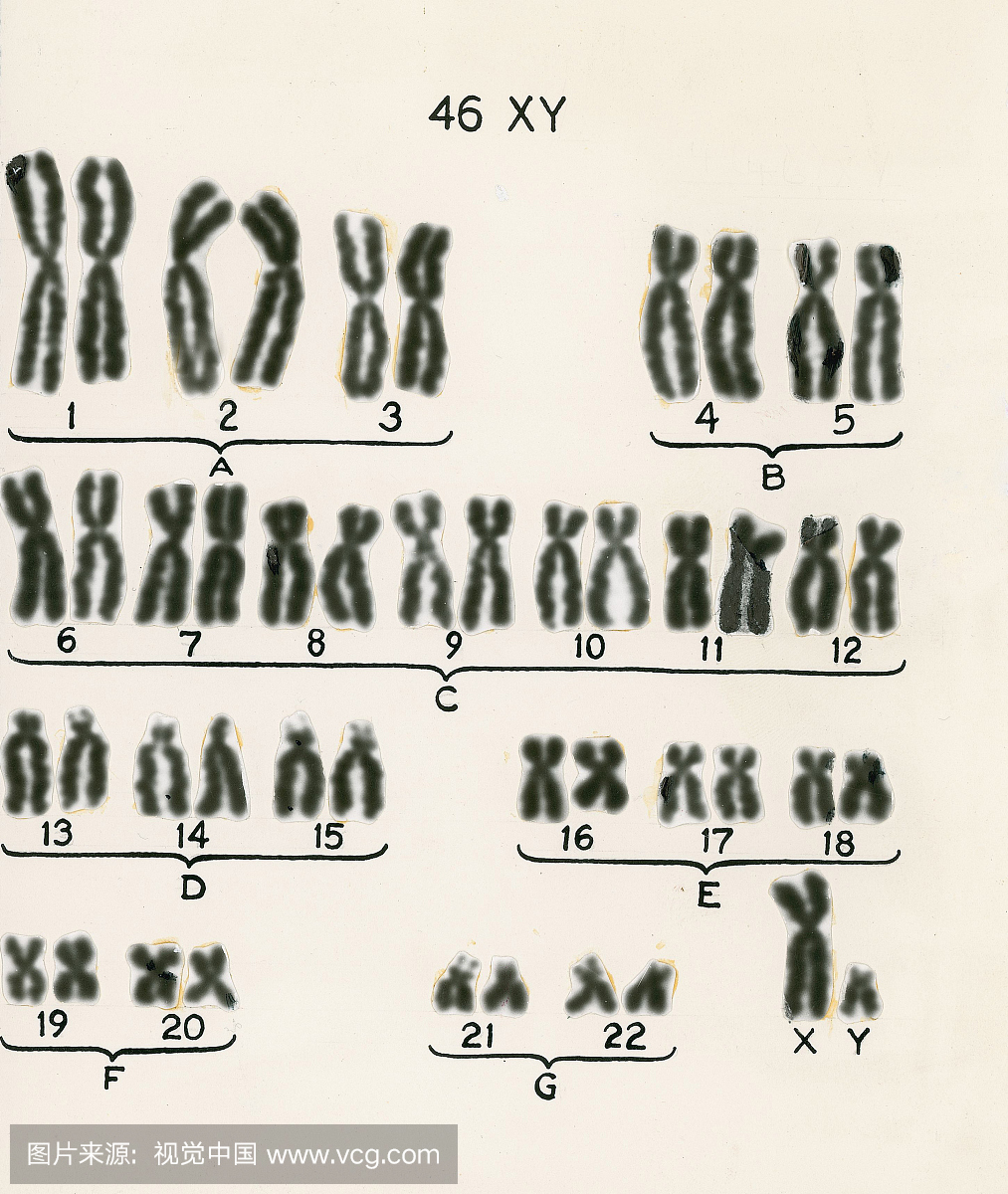 人类染色体正常雄性核型显示全部46条染色体