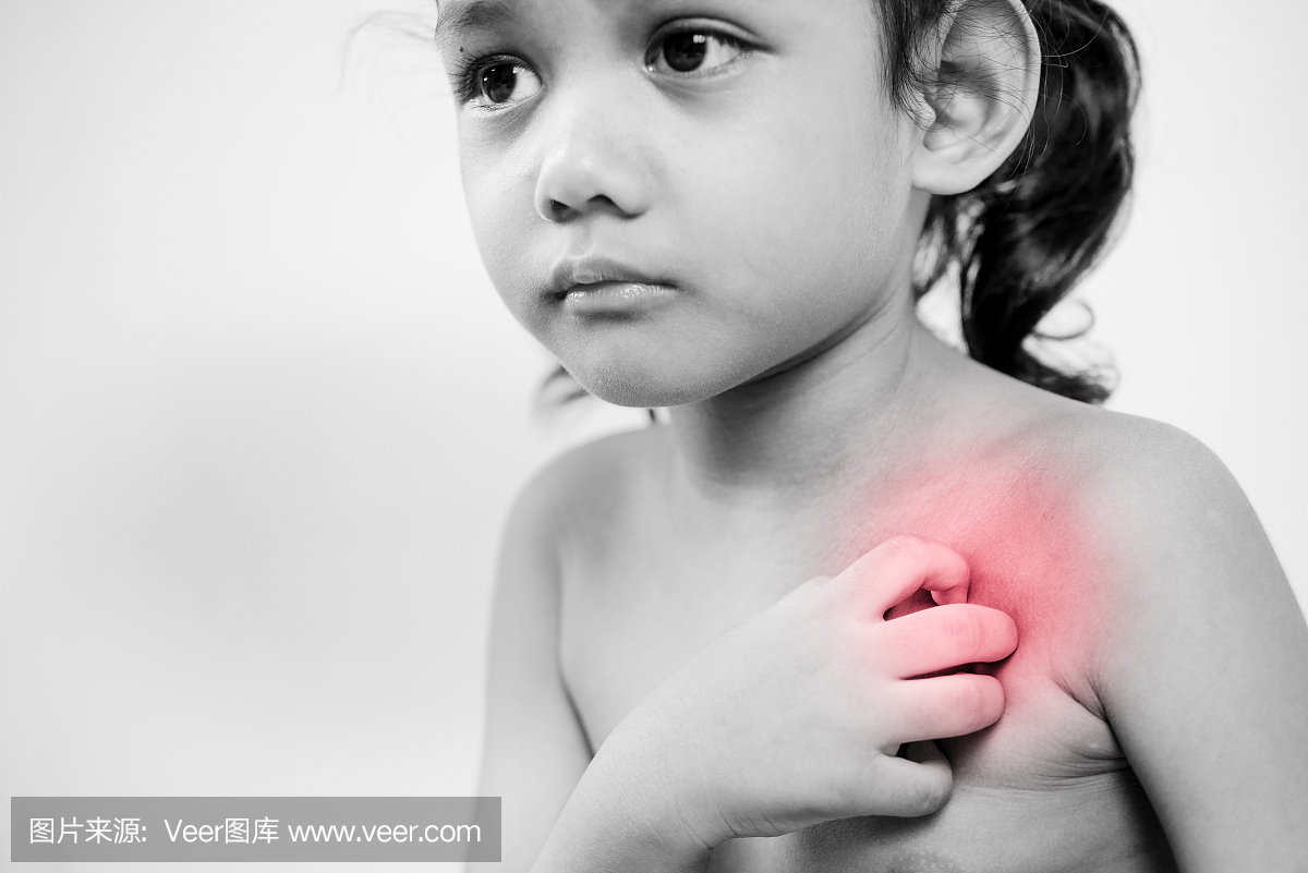 小女孩用手,颈部,瘙痒,医疗保健搔痒