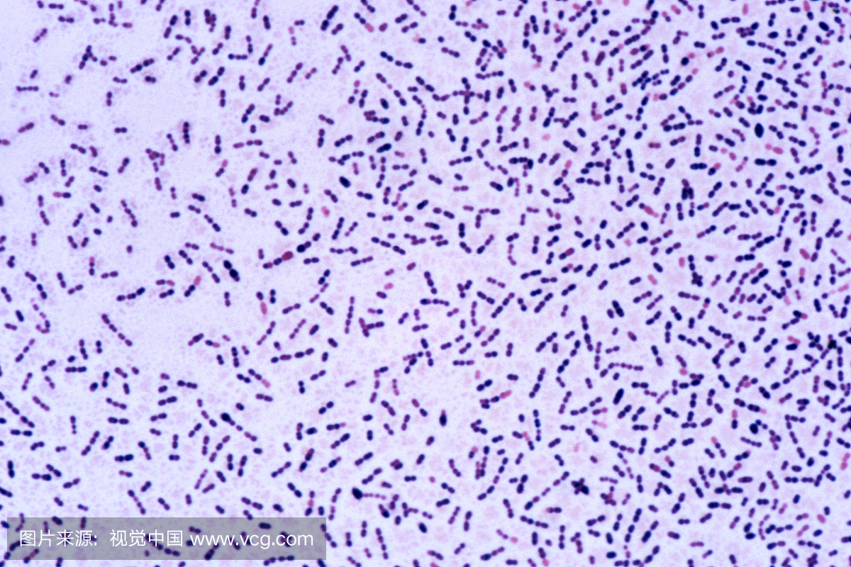 细菌链球菌(肺炎球菌)肺炎链球菌,成对和链条生