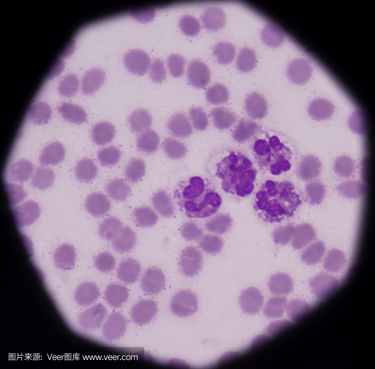 嗜曙红细胞,嗜酸性粒细胞,嗜中性粒细胞,中性粒