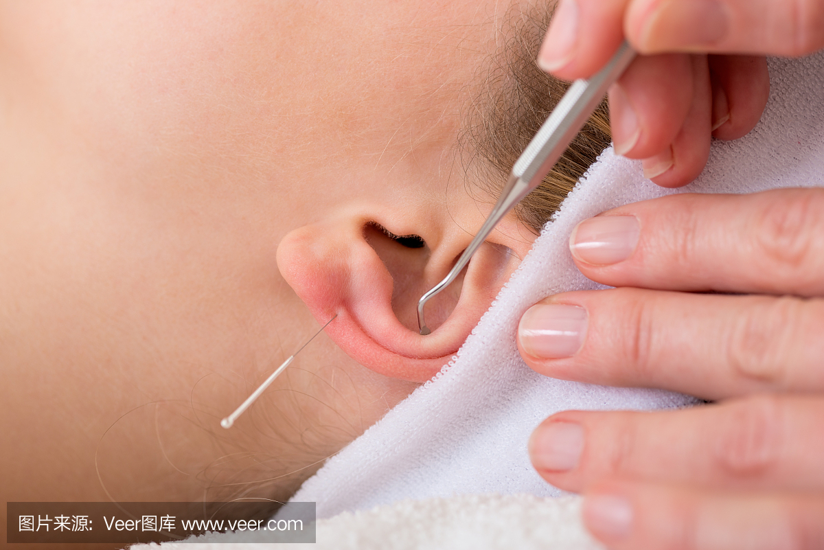 耳针疗法,肺叶,脑叶,耳垂