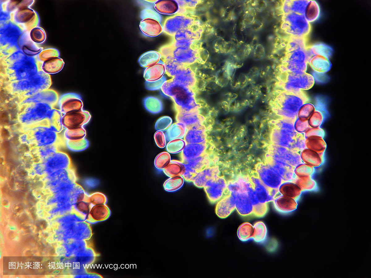 教育,建筑结构,蘑菇,人体肌肉结缔组织
