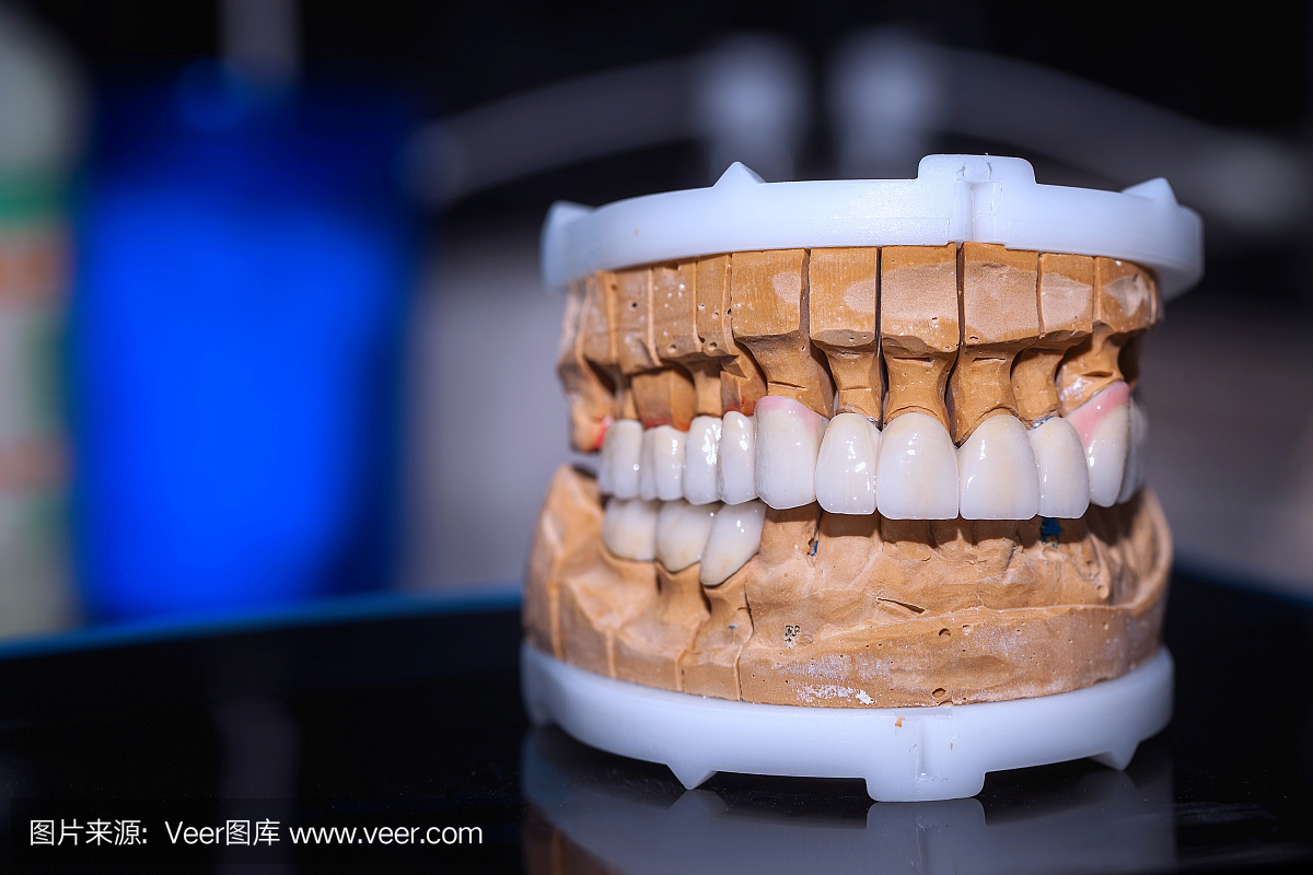 在牙医牙科瓷假体植入牙