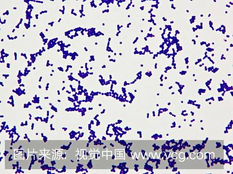 革兰氏阳性细菌(Cocci)。革兰氏阳性菌是在革