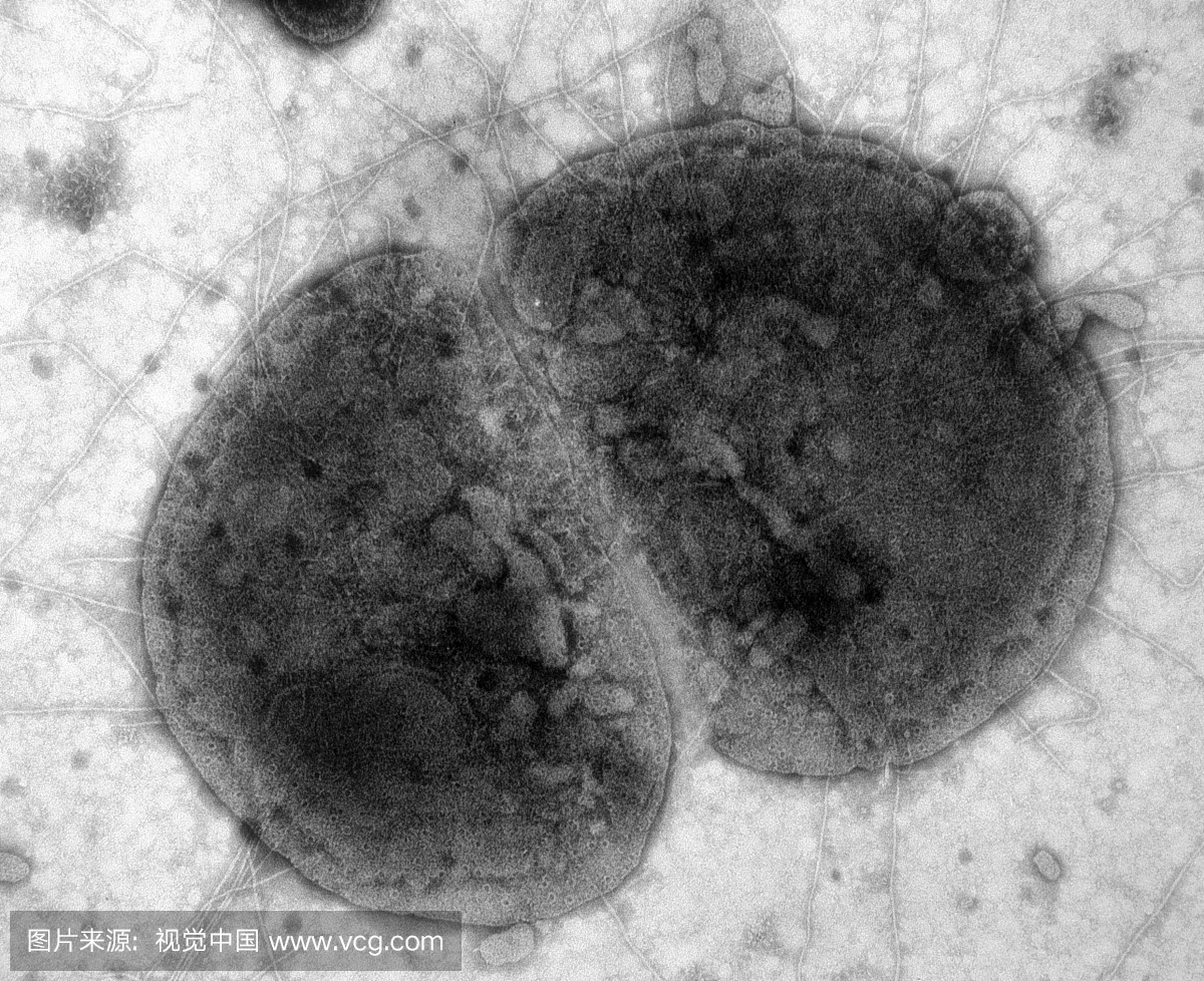 淋病奈瑟菌越来越难以治愈，中国地区抗药性高达19%！-搜狐大视野-搜狐新闻