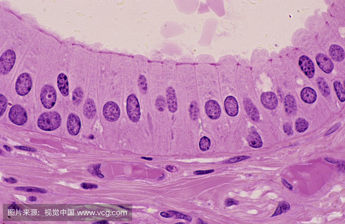 分层柱状上皮。下颌下唾液腺管,250X显示:高柱