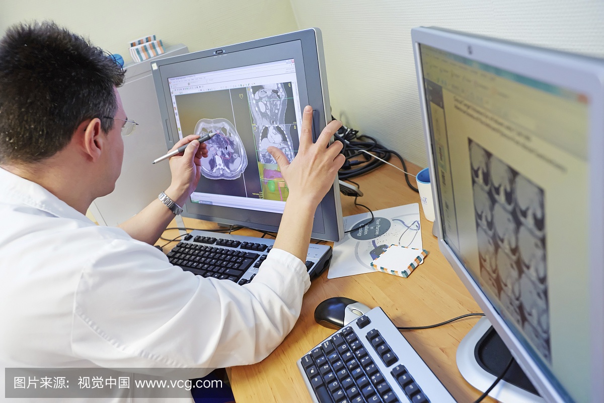 Doctor reviewing test results. IMRT, Intensity Mo